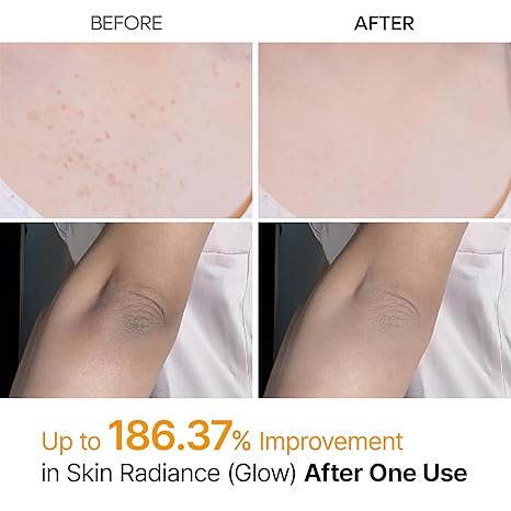 Dr.Melaxin Peel Shot Kojic Acid Turmeric Body Exfoliator Spray 6.76 fl.oz - AHA PHA Niacinamide Body Scrub for KP Bumps, Dark Spots, Uneven Skin Tone, Dead Skin, Korean Skin Care