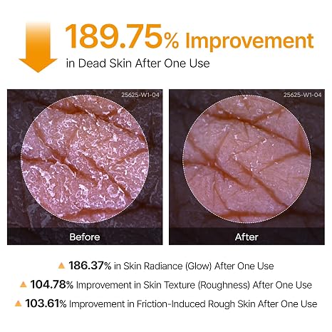 Dr.Melaxin Peel Shot Kojic Acid Turmeric Body Exfoliator Spray 6.76 fl.oz - AHA PHA Niacinamide Body Scrub for KP Bumps, Dark Spots, Uneven Skin Tone, Dead Skin, Korean Skin Care